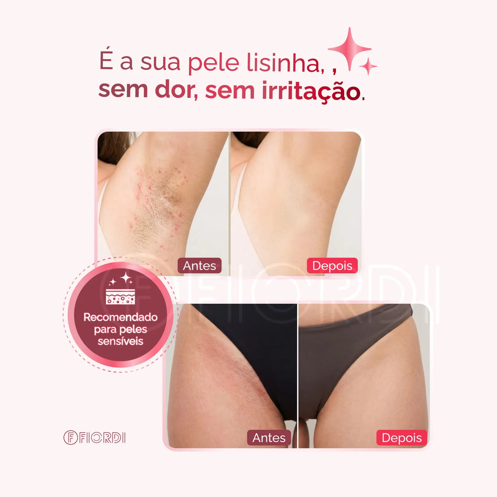 Depilador Elétrico 4 em 1 - DermaFlex®