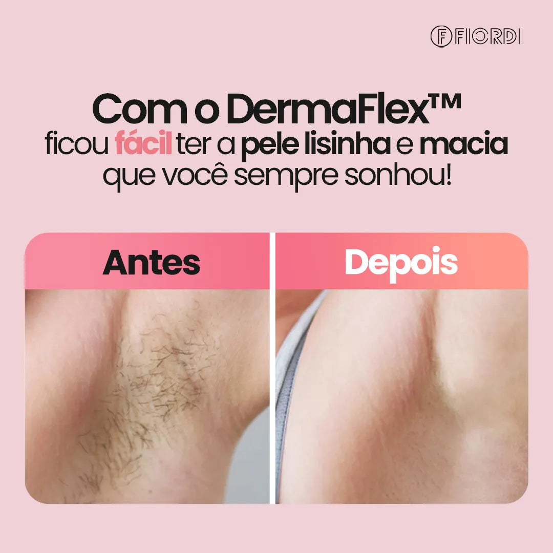 DermaFlex® - Depilador Elétrico 4 em 1