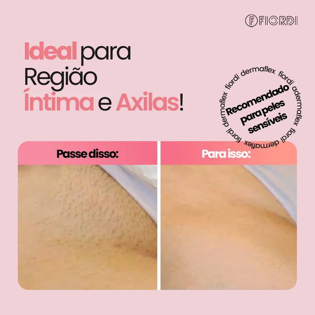 DermaFlex® - Depilador Elétrico 4 em 1